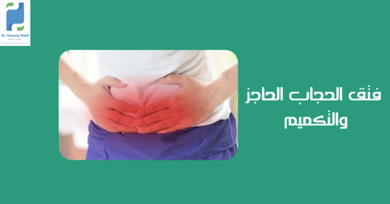 فتق الحجاب الحاجز والتكميم